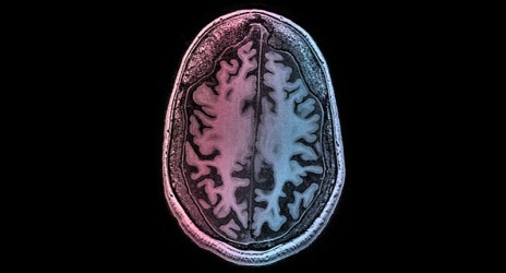 Η πατρότητα αλλάζει τον εγκέφαλο και τη σκέψη των ανδρών